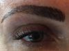 Healed at four months and eyeliner was added to client