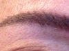Brow after