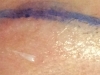 Before tattoo of brow