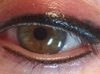 Repair of previous eyeline..