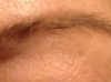 Brow before