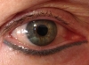 Under eye shading Gray